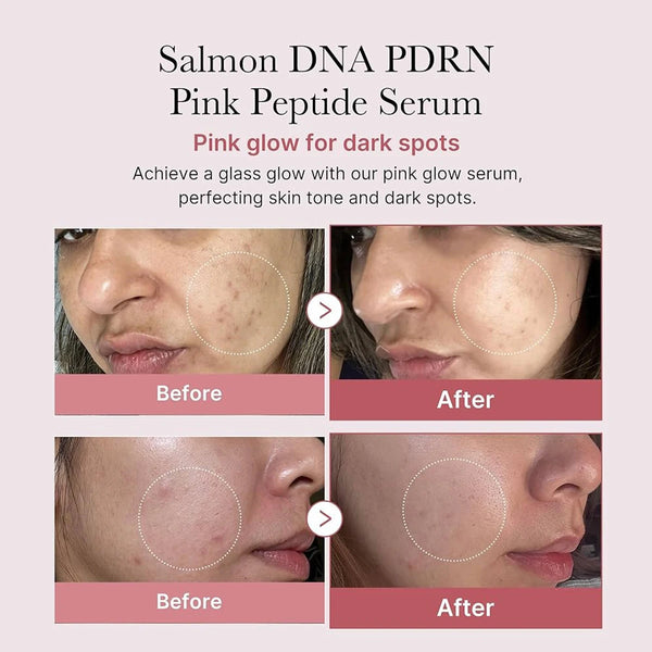 Salmon DNA Revive Face Serum